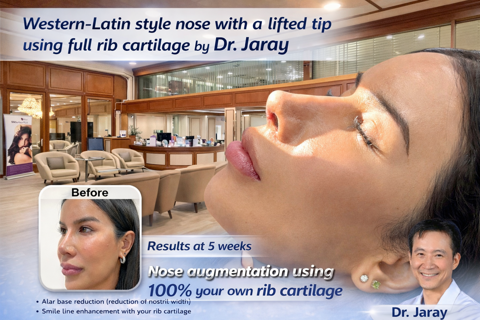 Elevating Natural Beauty with Structural Rhinoplasty