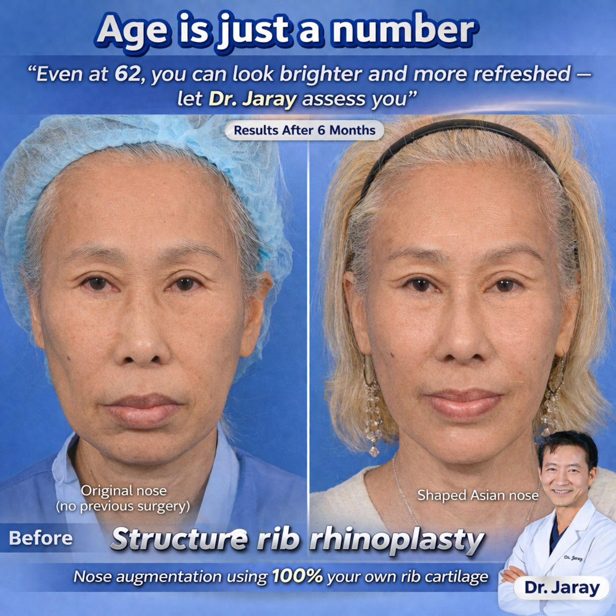 Refined, Natural Results at Any Age