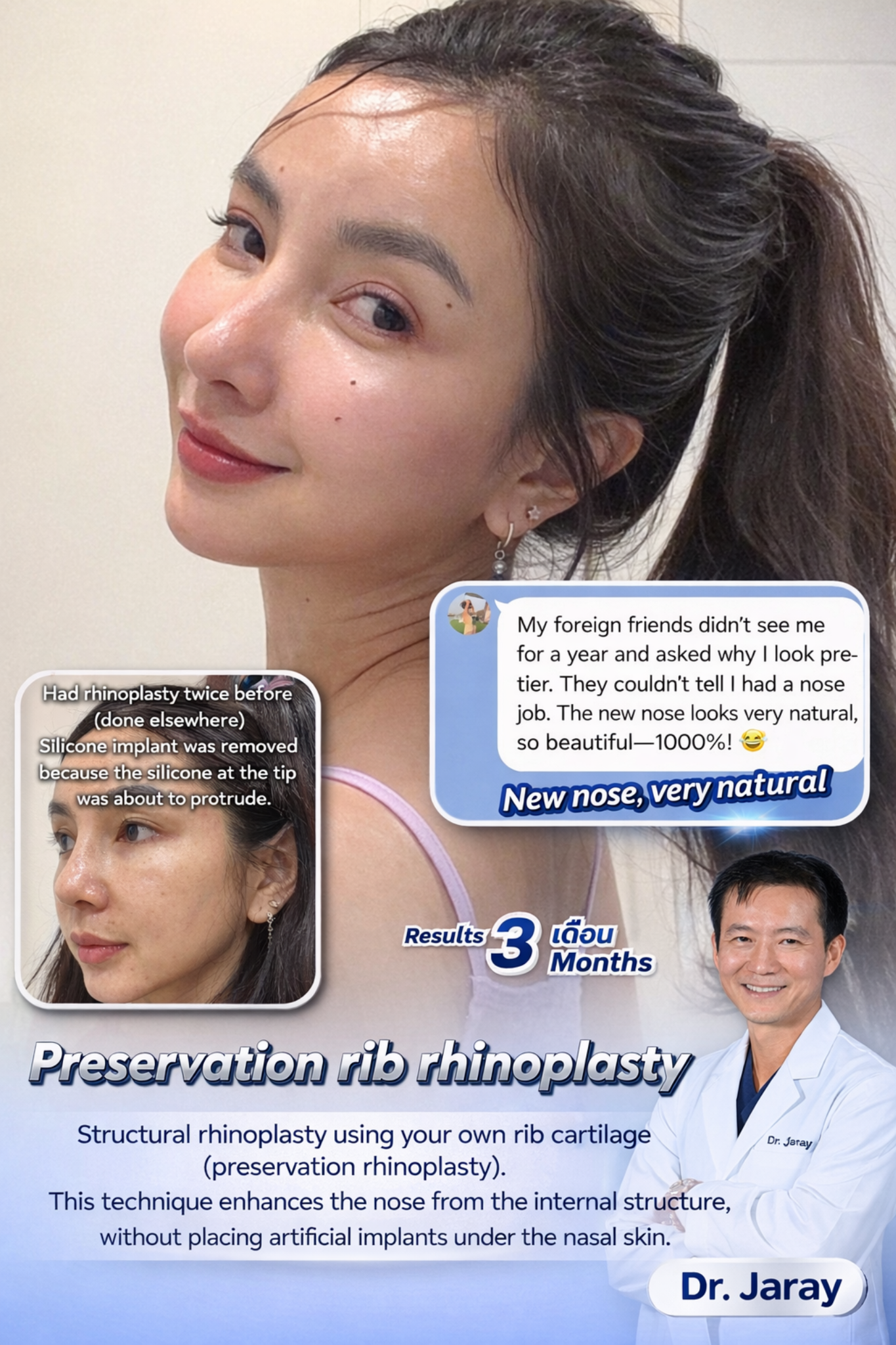 Promo image for preservation rib rhinoplasty: smiling woman with before/after inset and a doctor portrait, highlighting a natural-looking nose.