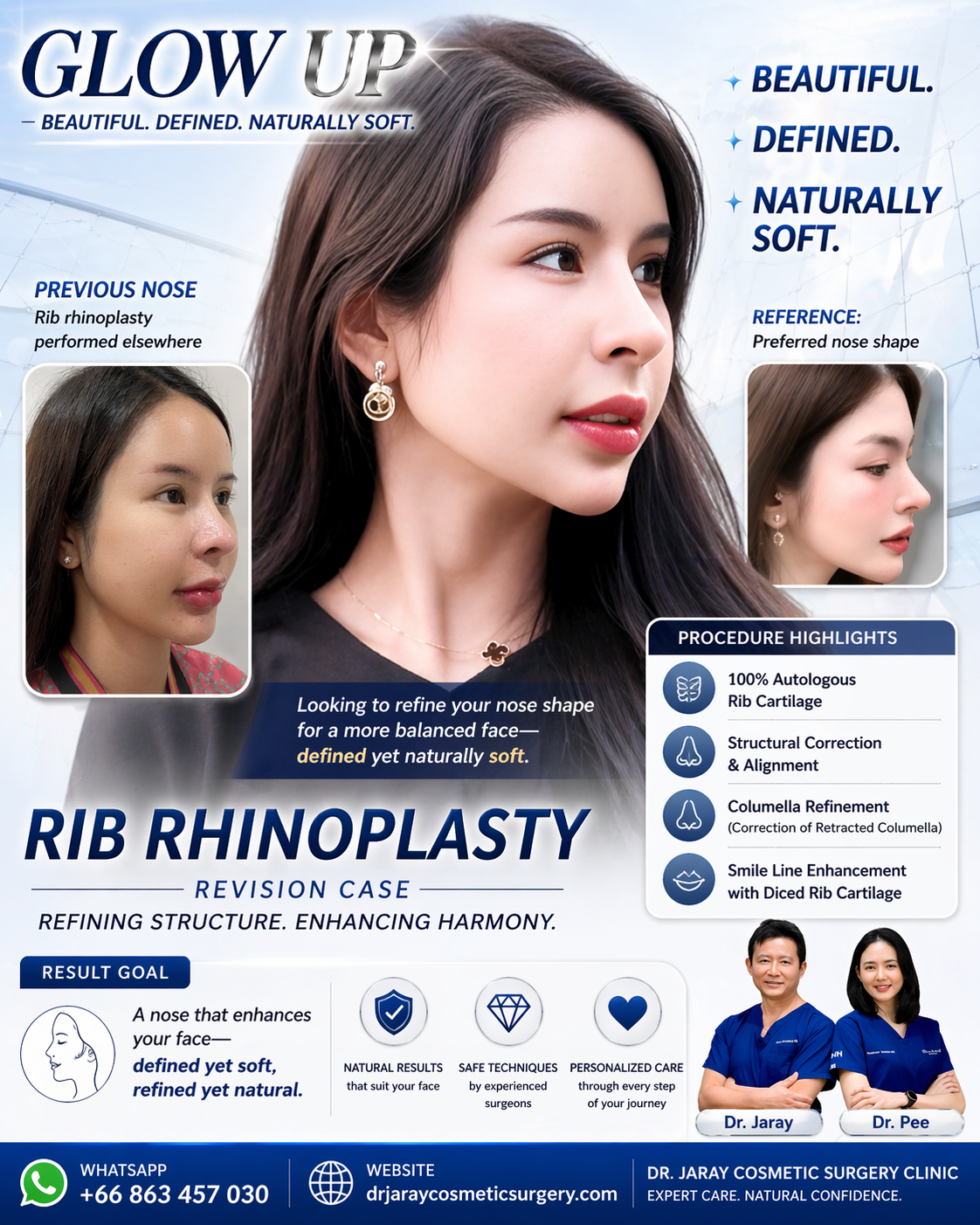 Promotional poster for rib rhinoplasty showing a womanโs refined side profile with before-and-after insets and the 'Glow Up' headline.