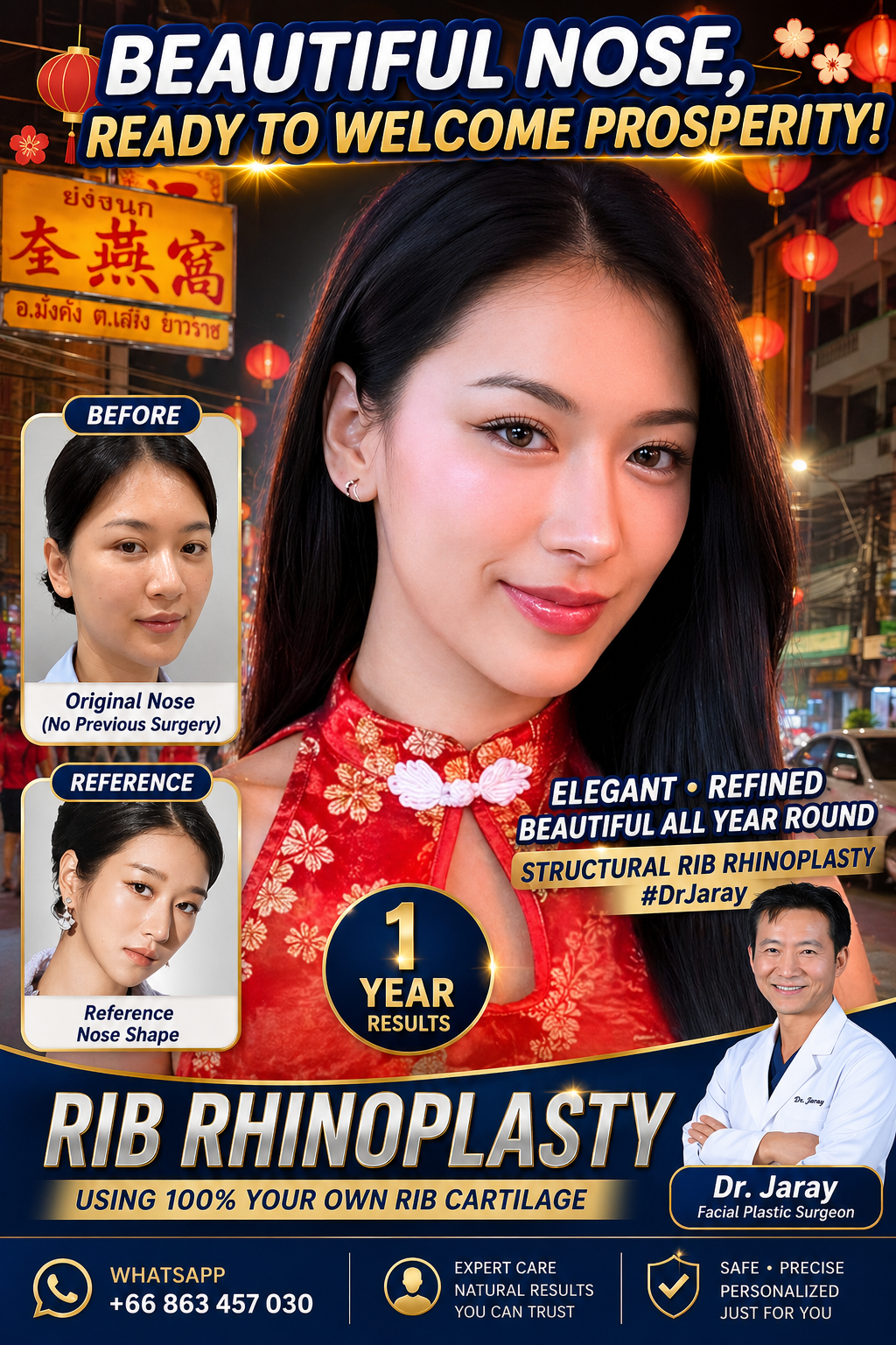 Promotional poster for rib rhinoplasty: smiling woman in red cheongsam; before and reference photos, surgeon Dr. Jary featured, bold headlines.